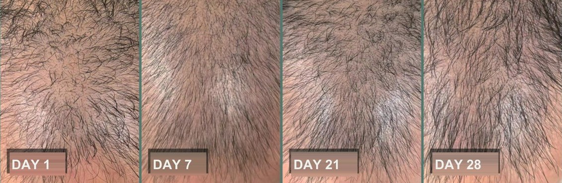 Male vertex · another user · day 1 / 7 / 21 / 28