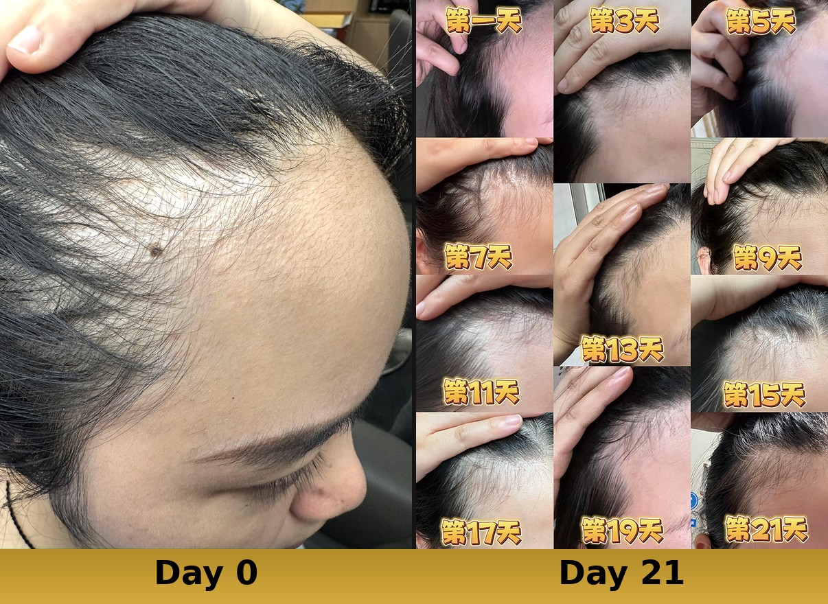Day 0 photo reference — hairline top-down angle eyebrows visible